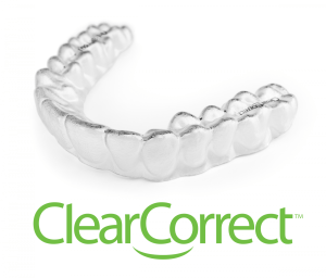 Image of clear braces